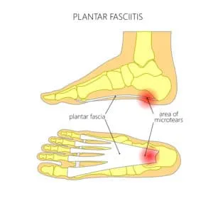 Reasons for heel hot sale pain after sitting