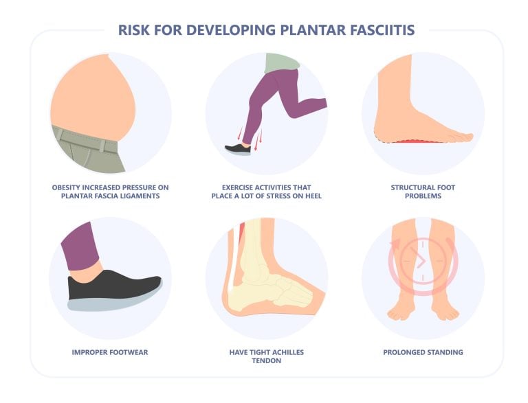 plantar fasciitis exercises