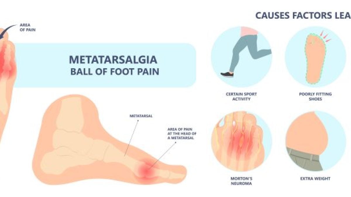 What Causes Pain on Bottom of Foot Ball Ball of Foot Pain ...